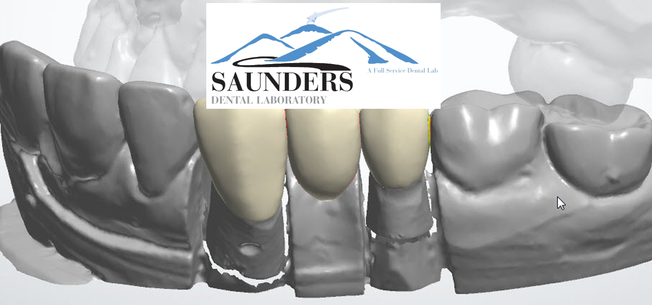 Saunders Dental Laboratory